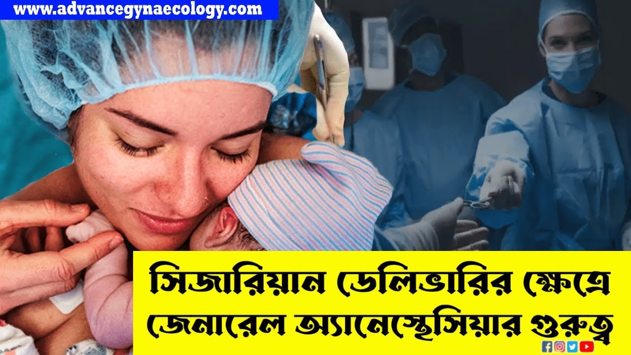 সিজারিয়ান ডেলিভারিতে জেনারেল অ্যানেস্থেসিয়ার কতটা নিরাপদ ┃General anesthesia for Cesarean delivery